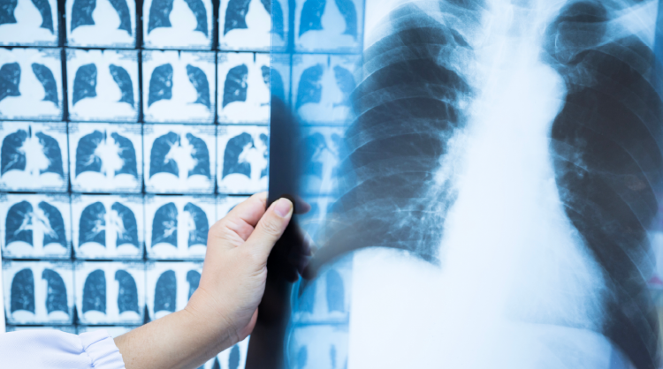 Coal Board Mine Medicals