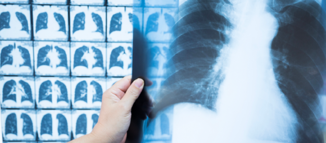 Coal Board Mine Medicals